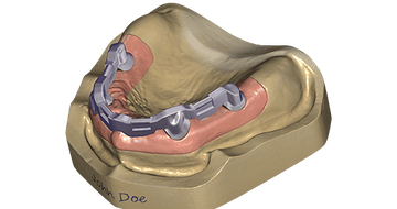 exocad Bar (Perpetual Initial Purchase)